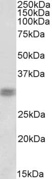 IHC-plus™ CRD / CRX Antibody (aa284-295)