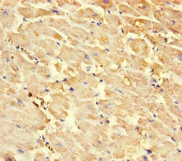 RYR2 / Ryanodine Receptor 2 Antibody