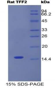 Rat TFF2 / SP Protein (Recombinant His)