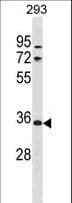 VSIG2 Antibody (aa250-278)