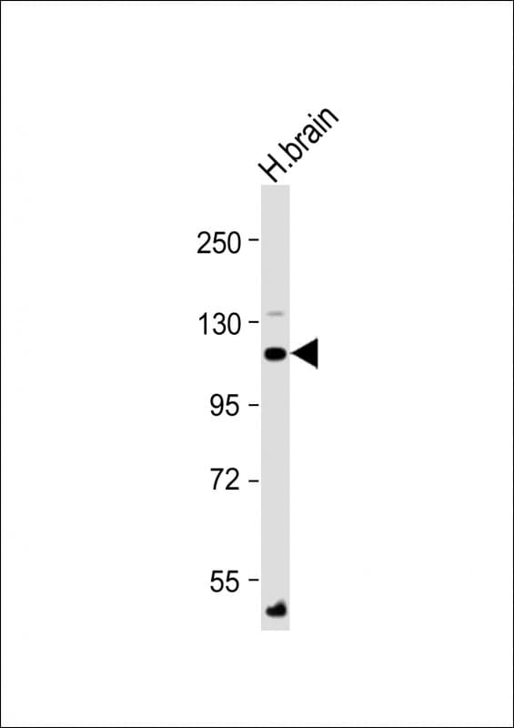ATP1A4 Antibody (N-Terminus)