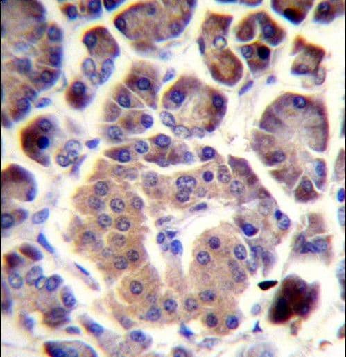 Polyclonal Rabbit anti-Human TRIM36 Antibody (aa310-339, IHC, WB)