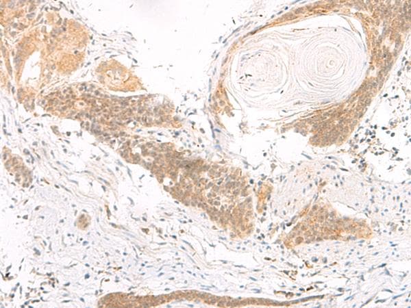 Polyclonal Rabbit anti-Human DGCR6L Antibody (IHC)