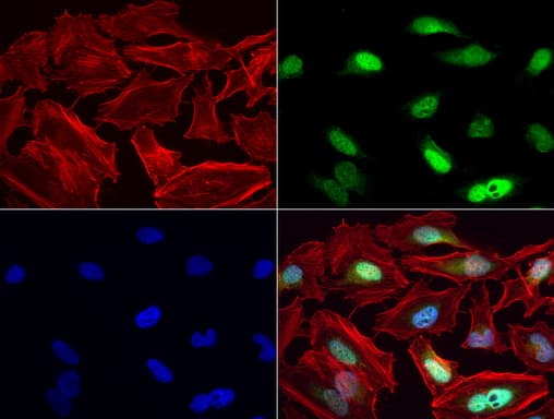 Monoclonal Mouse anti-Human MGMT Antibody (clone UMAB52, IHC, IF, WB)