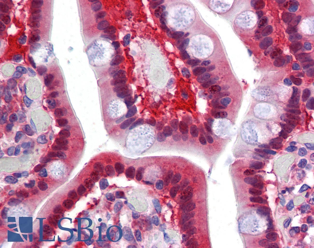 IHC-plus™ Polyclonal Rabbit anti-Human TMPRSS4 Antibody (Internal)