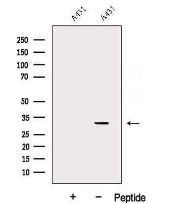 Polyclonal Rabbit anti-Human DENR / Density Regulated Antibody (WB)