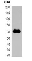 Polyclonal Rabbit DYKDDDDK Tag Antibody (WB)