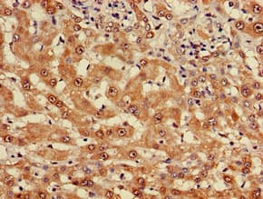 Polyclonal Rabbit anti-Human MYO7A / Myosin-VIIa Antibody (IHC, IF)