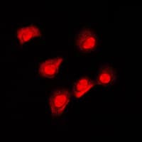 AIFM1 / AIF / PDCD8 Antibody (N-Terminus)