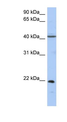 GUK1 / Guanylate Kinase 1 Antibody (aa71-120)