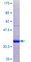 Human CST8 / CRES Protein (Recombinant GST)