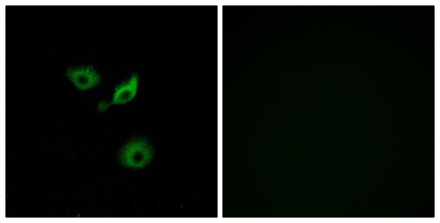 OR10AD1 Antibody (aa141-190)