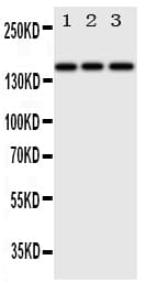 ERBB4 / HER4 Antibody (aa35-51)