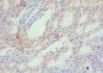 CBX4 Antibody (aa401-560)