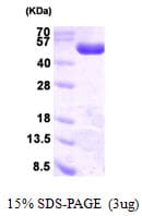 Human PGD Protein (Recombinant His)