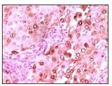 Monoclonal Mouse anti-Human S100A6 / Calcyclin Antibody (clone 7D11, IHC, WB)