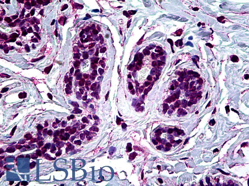 IHC-plus™ AML1 / RUNX1 Antibody (clone 2C10)