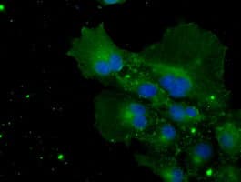 IHC-plus™ Monoclonal Mouse anti-Human CYPOR / POR Antibody (clone 6C4, IHC, IF, WB)