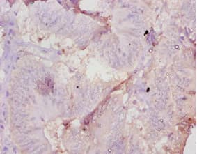 AMH / Anti-Mullerian Hormone Antibody