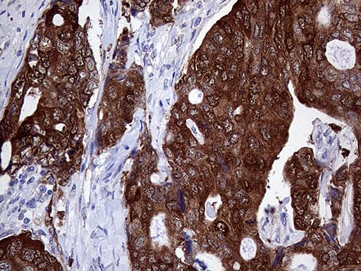 ASS1 / ASS Antibody (C-Terminus, clone OTI12G1)