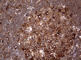 Monoclonal Mouse anti-Human PIK3C2A Antibody (clone OTI15H1, aa230-560, IHC, WB)