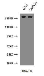 NES / Nestin Antibody (clone 2G2F7)