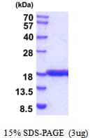 Human IL1F10 Protein (Recombinant)