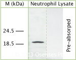 LL37 / Cathelicidin Antibody