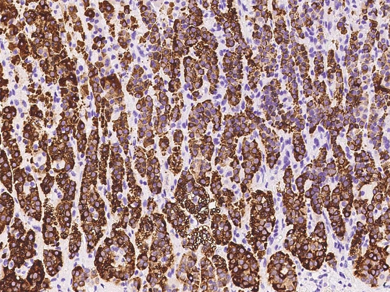 Polyclonal Rabbit anti-Human HSD3B1 Antibody (IHC)