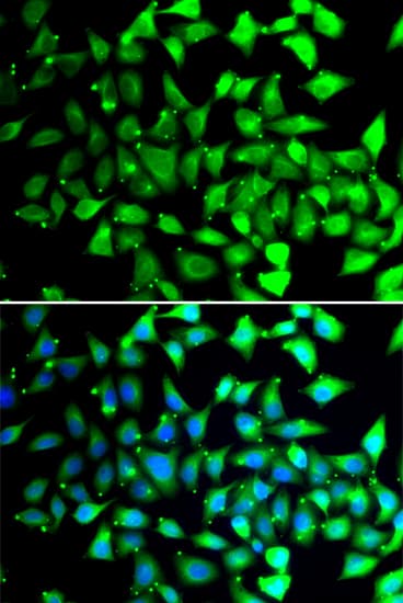 COPS6 / CSN6 Antibody
