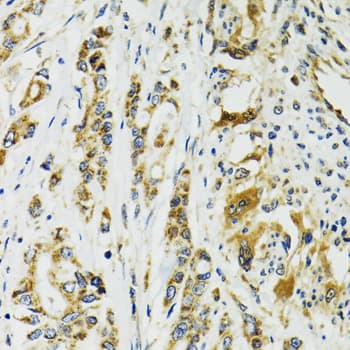 TNNC1 / Cardiac Troponin C Antibody