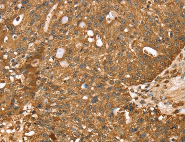 Polyclonal Rabbit anti-Human STARD5 Antibody (IHC, WB)