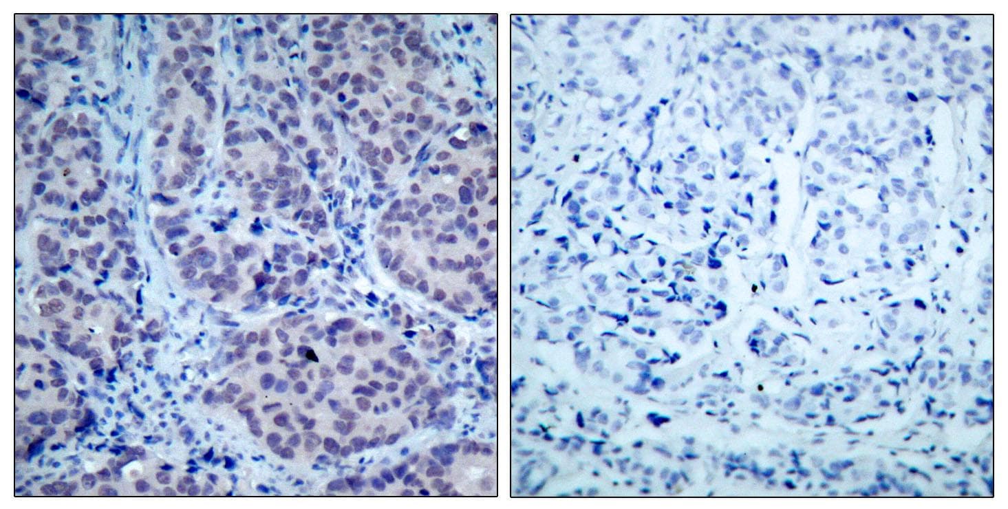 HDAC2 Antibody (p394)