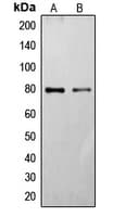 Polyclonal Rabbit anti-Human FZD6 / Frizzled 6 Antibody (Internal, WB)