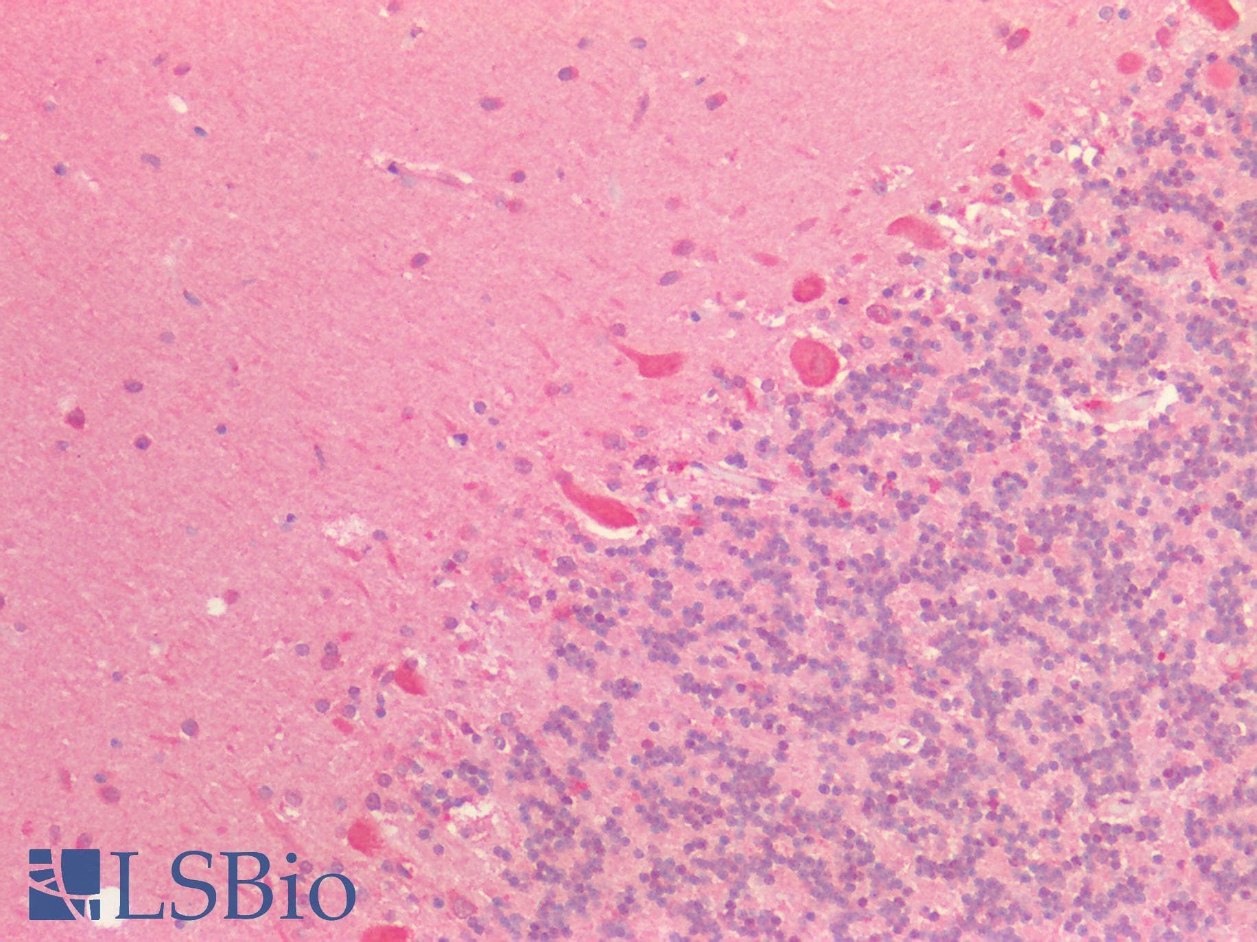 IHC-plus™ Polyclonal Rabbit anti-Human ISLET-1 / ISL1 Antibody (IHC, IF, WB)