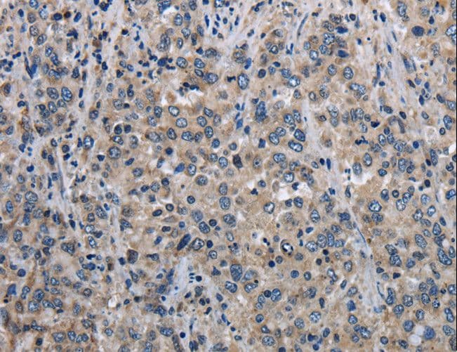 MCM3AP / GANP Antibody