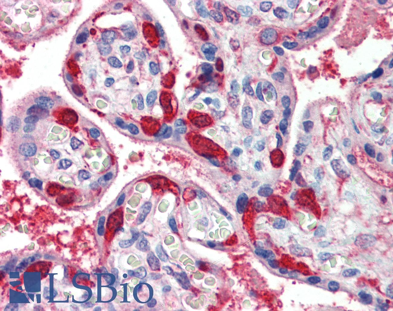 Polyclonal Rabbit anti-Human LDHB / Lactate Dehydrogenase B Antibody (C-Terminus, IHC, WB)