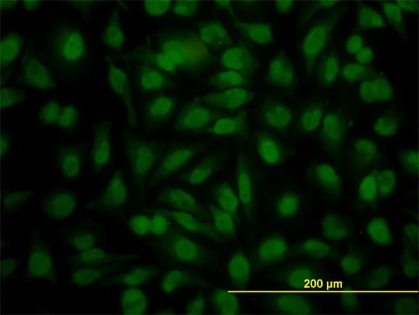 IHC-plus™ YY1 Antibody (clone 4A5)