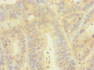 Polyclonal Rabbit anti-Human TGFB3 / TGF Beta3 Antibody