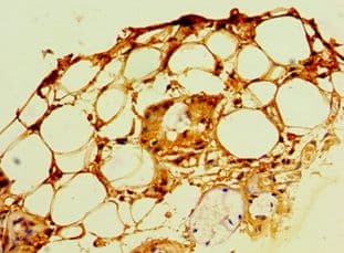 Polyclonal Rabbit anti-Human POP7 Antibody (aa1-140, IHC, WB)