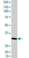 Monoclonal Mouse anti-Human RNF2 / RING2 / RING1B Antibody (clone 2B4, WB)