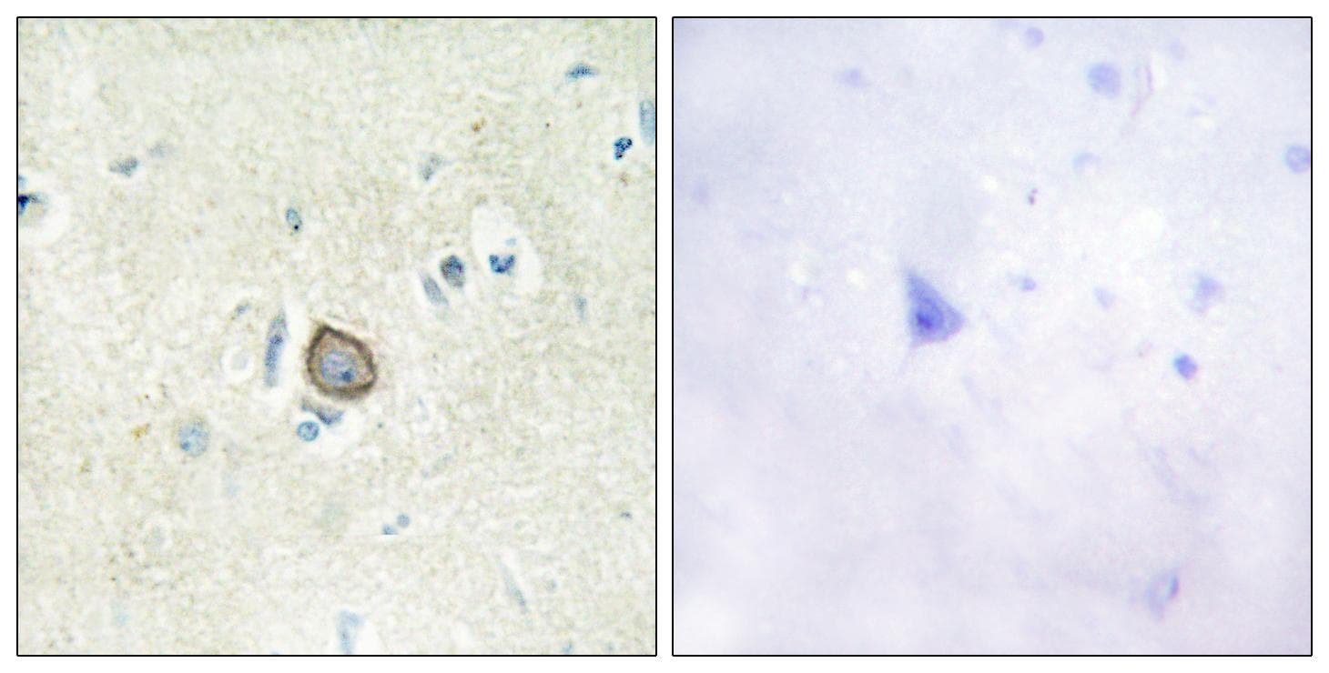 CELSR3 Antibody