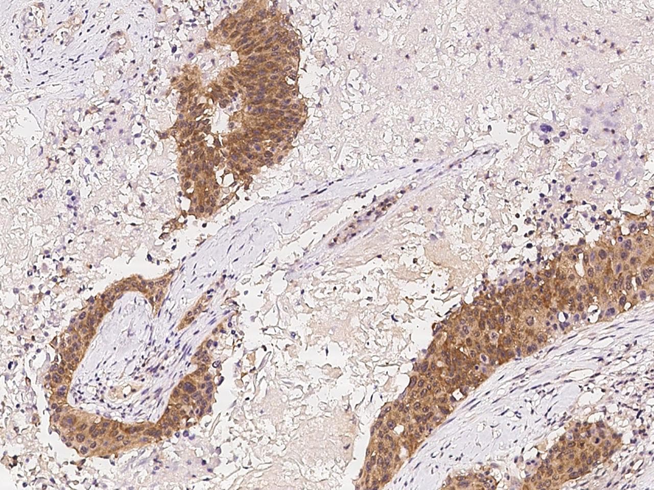ADAM10 Antibody (Preservative Free)