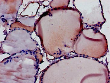 DIABLO / SMAC Antibody