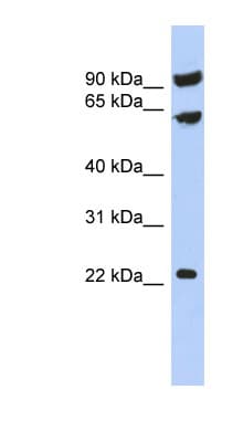 TIGD3 Antibody (aa395-444)