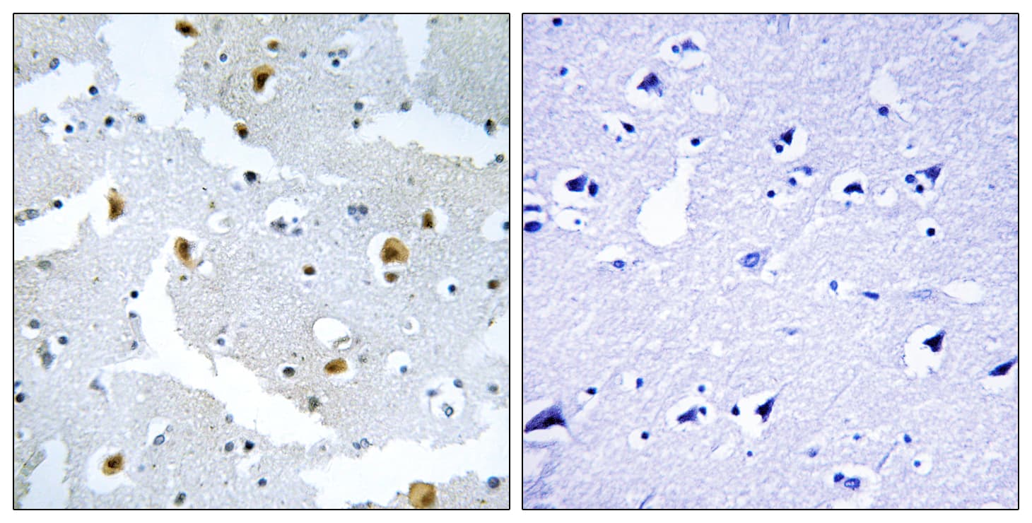 Polyclonal Rabbit anti-Human FMN2 / Formin 2 Antibody (aa1541-1590, IHC)