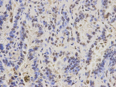 Polyclonal Rabbit anti-Human PAX3 Antibody (IHC, IF, WB)