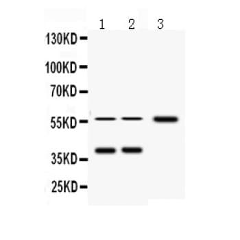 AHSG / Fetuin A Antibody (aa33-65)