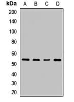 Polyclonal Rabbit anti-Human SPTLC2 / LCB2 Antibody (WB)