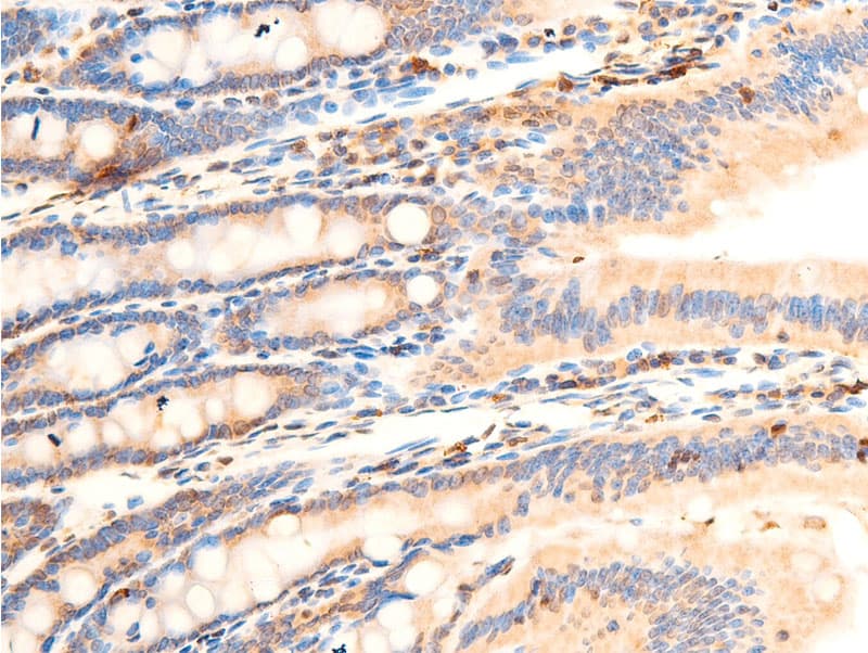 Polyclonal Rabbit anti-Human NFKBIA / IKB Alpha / IKBA Antibody (phospho-Ser32,phospho-Ser36, IHC, IF, WB)